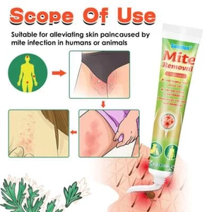 Mite Removal Ointments Anti Itching Scabies Kill Head Tre atment Cream Lice E5M4 - Bild 1 von 8