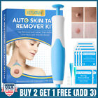 2 in 1 Micro Skin Tag Remover Device Kit Safe Painless Removal 2-8mm Band Tool