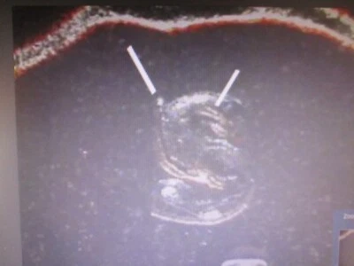 1946-S/S WASHINGTON QUARTER NGC MS65 RPM 2 FS-501 NOT DESIGNATED ON SLAB   039 - Image 1 of 4