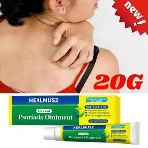 Antifungal Cream 20g - Anti Fungal Skin Cream Relief Jock Itch, Ringworm - Bild 1 von 9