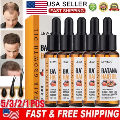 Aceite de Batana Natural 5/3X para el Crecimiento del Cabello, Aceite de Batana Orgánico, Reparar Cabello Dañado Foto 1 de 4