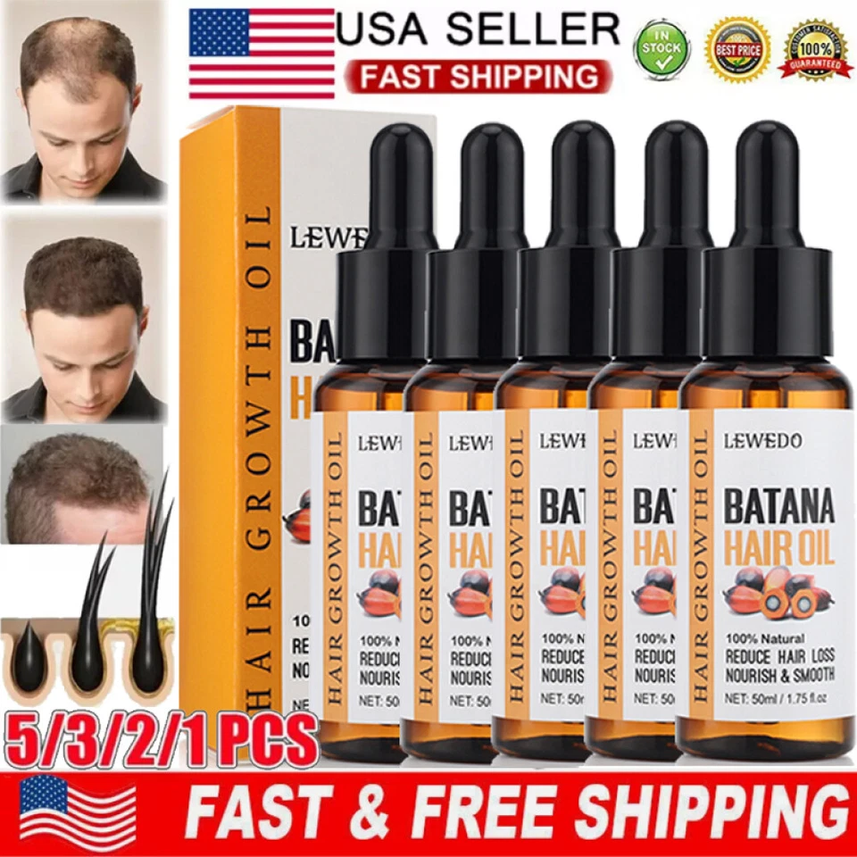 Aceite de Batana Natural 5/3X para el Crecimiento del Cabello, Aceite de Batana Orgánico, Reparar Cabello Dañado Foto 1 de 4