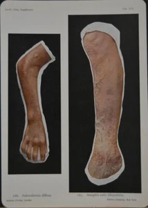 Antigua impresión artística de anatomía médica enfermedad humana Halloween original 1914 - Imagen 1 de 7