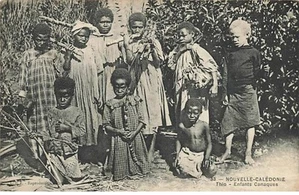 Nouvelle Calédonie - THIO - Enfants Canaques - Un enfant albinos - Bild 1 von 2