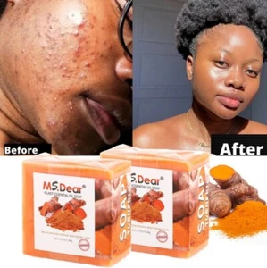 3× Turmeric Soap Skin Whitening Dark Spots lightening Acne Brightening Turmeric - Picture 1 of 15