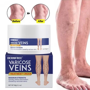 1-6XVaricose Veins Cream, Spider Veins Repair Cream, Varicose Treatment for Legs - Picture 1 of 27