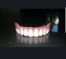 Protesi totale superiore, denti finti, Zähne, zahnersatz, prothese, dentures.