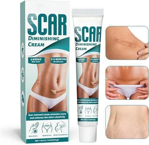 Scar Cream, Scar Removal Cream, Stretch Mark Removal Cream, Scar Erase, Skin Rep - Picture 1 of 7