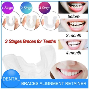 3Stage Dental Orthodontic Teeth Corrector Braces Tooth Retainer Straighten Tool - Picture 1 of 8