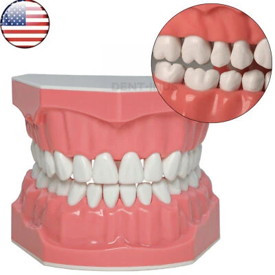 US Dental Teeth Typodont Model for Brushing Flossing Practice Teaching Study - Image 1 of 4