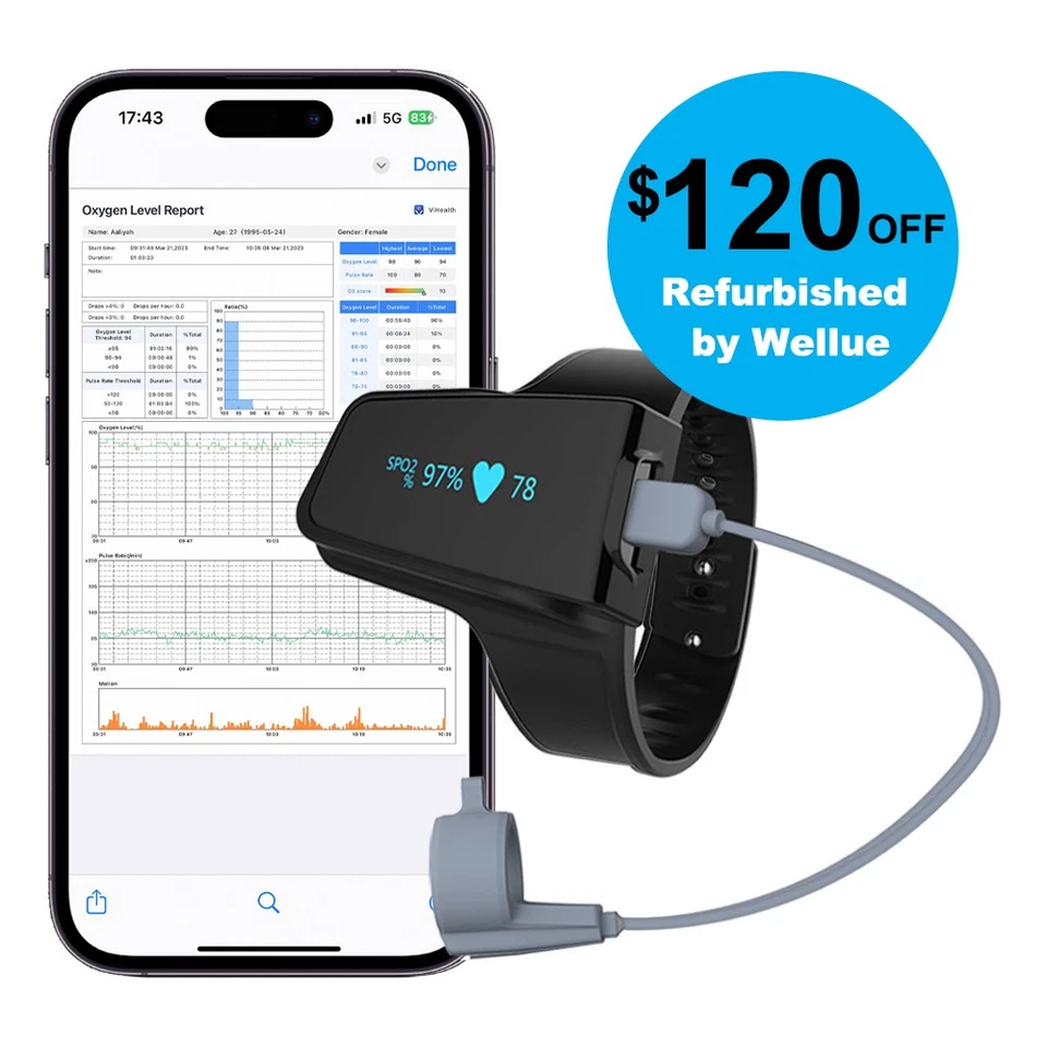 Wellue O2 Max with O2 Ring Probe 72 Hours Continuous Pulse Oximeter Dual alarm - Image 1 of 4