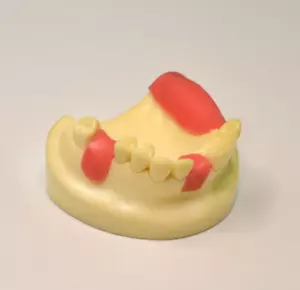 Modelo de implante dental faltante entrenamiento mandíbula superior odontología modelo educativo - Imagen 1 de 9