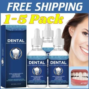 Paquete de 1/2/3/4/5 60 ml solución para el cuidado dental curación de cavidades armadura dental 2025 - Imagen 1 de 11