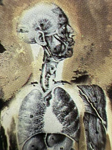 1991 DEATH HUMAN DEATH METAL CASSETTE CHUCK SCHULDINER ALTAMONTE SPRINGS FLORIDA - Picture 1 of 12