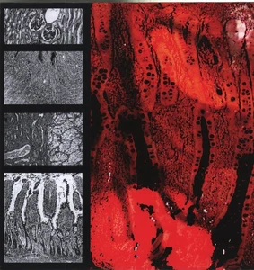 Medicine Noose/Spewn Split LP LP vinyl Germany Heavenly Vault 2018 split release - Bild 1 von 2