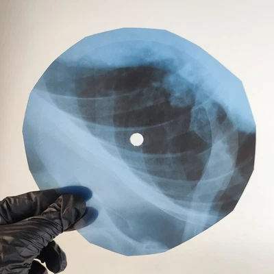 BLACK SABBATH EVIL WOMAN X-Ray USSR Record Roentgen Bone Ribs Music Vinyl - Image 1 of 2