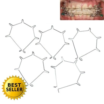 Ortodoncia Dental Anterior Par Raíz Arco Auxiliar Grande Mediano Pequeño Inferior Foto 1 de 4