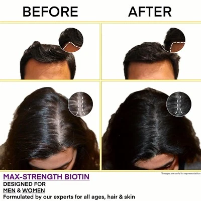 Biotina de alta potencia 10000 mcg - Salud del cabello, la piel y las uñas - 120 comprimidos vegetarianos Foto 1 de 4