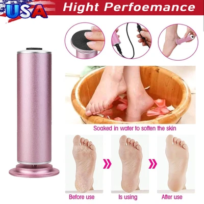 Electric Foot Callus Remover Dead Skin Remover for Dry Feet at-Home (Pink) - Image 1 of 4