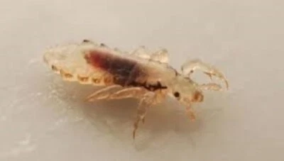 Plastic 4" Terminator Comb - Head Hair Lice Nits - Ultra Fine Tooth Double Sided - Image 1 of 4