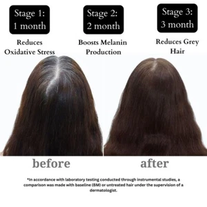 Antigraues Haarserum mit Arcolys® + Melanogray™ + Biotin | Grenzen der Haargrauung - Bild 1 von 5