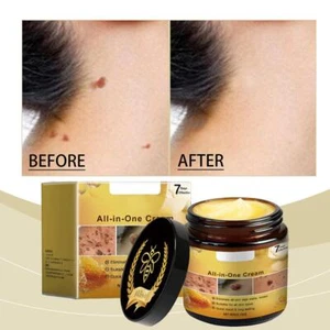 1*BeeVenom Skin Tag Removal TreatmentCream BodyCare Mole Corn Wart Remover Best - Picture 1 of 18