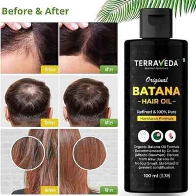 TERRAVEDA Dr Sebi Organic Raw Batana Oil from Honduras, for Thicker & Stronger Hair Growth
