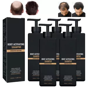 5x Spartan Shampoo,Spartan Root Activator Shampoo,Natural Hair Regrōwth Shampoos - Picture 1 of 15