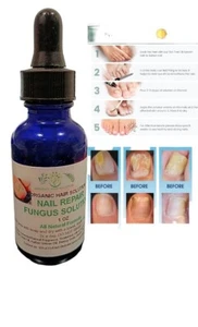 Organic Toenail Fungus Treatment Extra Strength - nail repair, toenail softener - Picture 1 of 3