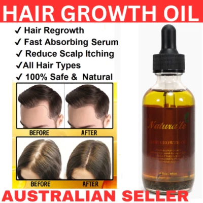 Hair Growth Serum for  Scalp Regrowth Thin Bald Hair Serum Oil Peppermint 60ml - Image 1 of 4