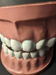 Giant Dental Model Teeth hinge articulates open. One Hinge &Some Teeth Has Wear  - Bild 1 von 15