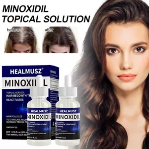 Extra Strength Men Women Hair Regrowth Solution Minoxidil 5% 2 Months Supply - Bild 1 von 18