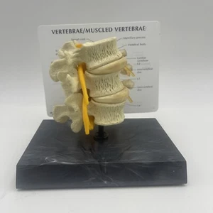 GPI 1500 Life-Size Lumbar Vertebrae with Lumbar Nerve Anatomical Model - Picture 1 of 7