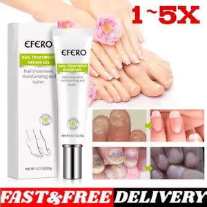 EFERO Nail Anti Fungal Infection Gel Treatment Hand Foot Cream Toenail Remover~ - Picture 1 of 18