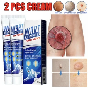 2X Wart Remover Fast Acting Gel Wart Remover Freeze Off Fast-Acting Ointment - Picture 1 of 18