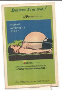 RIPLEY BELIEVE IT OR NOT HUMAN AUTOMOBILE TIRE EDEMA NEW YORK WORLDS FAIR 1940 - Picture 1 of 1