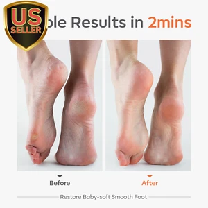 Glass Foot File, Professional Foot Scrubber and Callus Remover, Heel Scraper ... - Picture 1 of 9