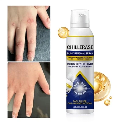 Spray facial calmante renovación de golpes 60 ml spray corporal para enrojecimiento de la piel Foto 1 de 4