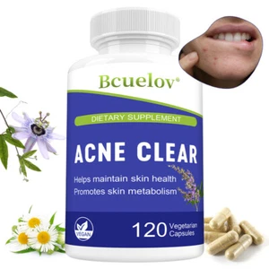Acné Clear - Cápsulas de tratamiento del acné, mejorar la salud de la piel, desintoxicación - Imagen 1 de 10