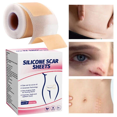 New Silicone Gel Sheet Patch Scar Removal Strips Wound Skin Repair Treatment Tap - Image 1 of 4