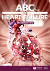 Insuffisance cardiaque Michael K., Lip, Gregory Y. H., Davis, Russell C. D