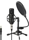 New ZingYou Condenser Microphone Pro Audio Broadcasting Equipment BF001 CP