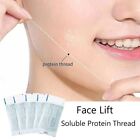 Face Lift Protein Thread Lifting Lifting Instant Face Soluble Protein Thread