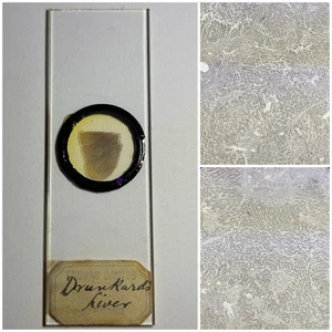 Antique Microscope Slide. Showing Drunkards Liver. By Thomas Groves. - Picture 1 of 3