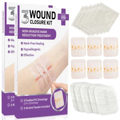(6 CT) 2.3 X 2.3” Butterfly Closures - Wound Closure Strips - Zip Stitch Woun... - Image 1 of 4