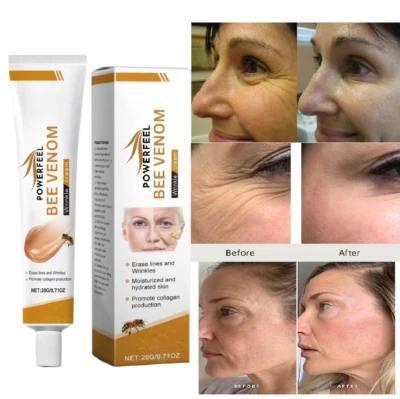 Bee Venom Wrinkle Remover Cream For moisturizer Brightening skin -20gm FREE SHIP - Image 1 of 4