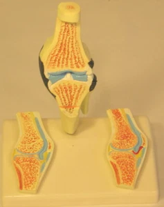 Arthritis bone joint sections anatomical model life-size New - Picture 1 of 5
