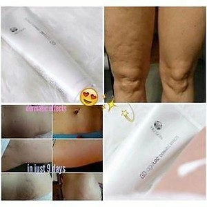 nu skin cellulite cream