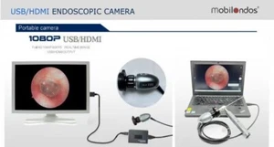 USB and HDMI Portable FULL HD endoscopic camera 1080P 60FPS - Picture 1 of 12