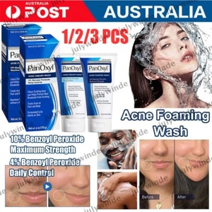 PanOxyl Benzoyl Peroxide 10% Foaming Acne Wash Skin Care 4% Daily Control Cream - Picture 1 of 17
